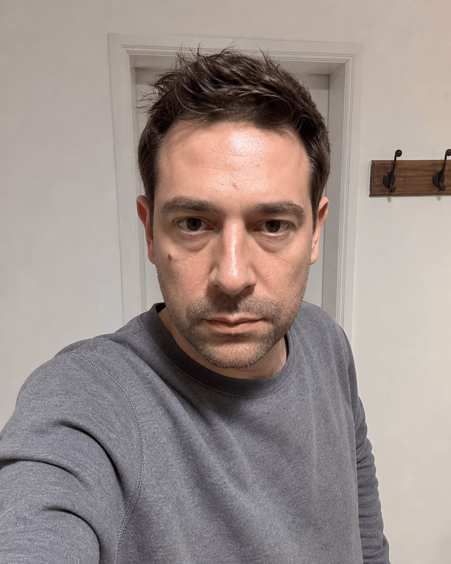 Selfie pris de trop près, éclairage dur et fond de couloir, exemple de photo à ne pas mettre sur un CV