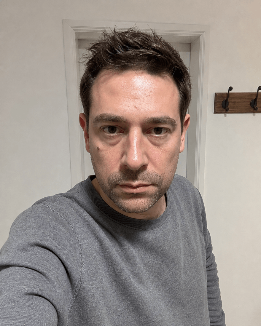 Derselbe Mann als Selfie mit ausgestrecktem Arm in einer Wohnung, Deckenlampe von oben,
            Schatten in den Augenhöhlen, leichte Weitwinkelverzerrung